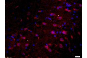 Paraformaldehyde-fixed, paraffin embedded rat brain, Antigen retrieval by boiling in sodium citrate buffer (pH6) for 15min, Block endogenous peroxidase by 3% hydrogen peroxide for 30 minutes, Blocking buffer (normal goat serum) at 37°C for 20min, Antibody incubation with 	Tau protein Polyclonal Antibody, Unconjugated  at 1:200 overnight at 4°C, followed by a conjugated secondary Goat Anti-Rabbit IgG, Cy3 conjugated-Cy3)used at 1:200 dilution for 40 minutes at 37°C. (tau 抗体  (AA 681-758))