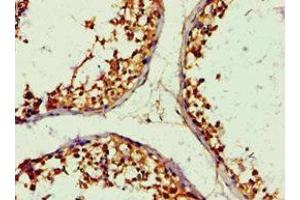 Immunohistochemistry of paraffin-embedded human testis tissue using ABIN7143676 at dilution of 1:100 (ALDH1B1 抗体  (AA 278-517))