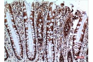 Immunohistochemistry (IHC) analysis of paraffin-embedded Human Colon, antibody was diluted at 1:100. (NKp44/NCR2 抗体  (Internal Region))