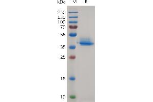 SDS-PAGE (SDS) image for Annexin A2 (ANXA2) (AA 2-339) protein (His tag) (ABIN7490891)