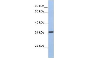 Western Blotting (WB) image for anti-Solute Carrier Family 25, Member 28 (SLC25A28) antibody (ABIN2458805) (SLC25A28 抗体)