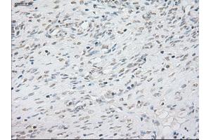 Immunohistochemical staining of paraffin-embedded lung tissue using anti-NEUROG1mouse monoclonal antibody. (Neurogenin 1 抗体)