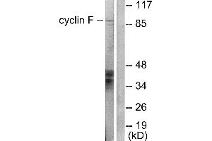 Western blot analysis of extracts from HeLa cells, using Cyclin F antibody (#C0168).