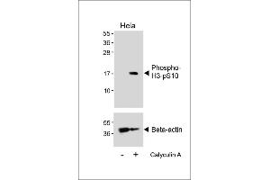 Western blot analysis of lysates from Hela cell line, untreated or treated with 20 % FBS + 100nM Calyculin A, using Phospho-HIST1H3B3(S10) Antibody (upper) or Beta-actin (lower). (HIST1H3B3 (pSer10) 抗体)