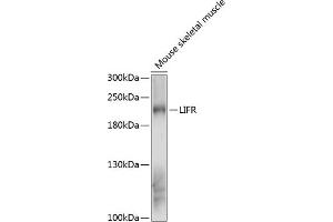 Western blot analysis of extracts of mouse skeletal muscle, using LIFR antibody (ABIN6132110, ABIN6143204, ABIN6143205 and ABIN6216534) at 1:3000 dilution. (LIFR 抗体  (AA 500-700))