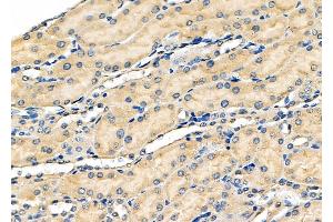 ABIN6259879 and ABIN6278421 at 1/100 staining Mouse kidney tissue by IHC-P. (ALDH3A1 抗体  (C-Term))