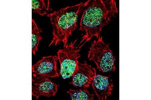 Fluorescent confocal image of  cell stained with FOXO6 Antibody (Center) (ABIN1881351 and ABIN2845586). (Foxo6 抗体  (AA 154-181))
