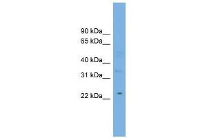 WB Suggested Anti-MBL2 Antibody Titration:  0. (MBL2 抗体  (Middle Region))
