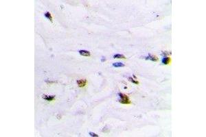 Immunohistochemical analysis of ZNF7 staining in human brain formalin fixed paraffin embedded tissue section. (ZNF7 抗体  (N-Term))