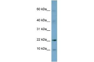 WB Suggested Anti-DPPA5 Antibody Titration: 0. (DPPA5 抗体  (N-Term))