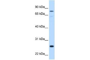 GSTM2 antibody used at 0. (GSTM2 抗体)