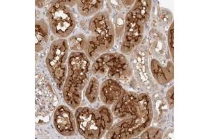 Immunohistochemical staining of human kidney with MICALL2 polyclonal antibody  shows strong cytoplasmic and membrane positivity in cells in tubules. (MICALL2 抗体)