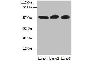 Western blot All lanes: GDI2 antibody at 2 μg/mL Lane 1: Mouse brain tissue Lane 2: HepG2 whole cell lysate Lane 3: MCF-7 whole cell lysate Secondary Goat polyclonal to rabbit IgG at 1/10000 dilution Predicted band size: 51, 46 kDa Observed band size: 51 kDa (GDI2 抗体  (AA 1-445))
