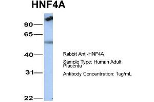 Host: Rabbit  Target Name: HNF4A  Sample Tissue: Human Adult Placenta  Antibody Dilution: 1. (HNF4A 抗体  (N-Term))