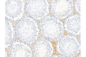 ABIN6260885 and ABIN6268761 at 1/100 staining Rat testis tissue by IHC-P.