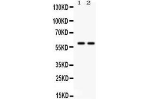 Anti- TH Picoband antibody, Western blotting All lanes: Anti TH  at 0. (TH 抗体  (Middle Region))