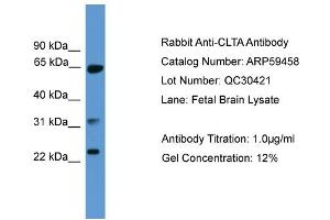 WB Suggested Anti-CLTA  Antibody Titration: 0. (CLTA 抗体  (C-Term))