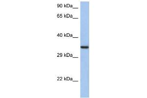 WB Suggested Anti-HORMAD2 Antibody Titration: 0. (HORMAD2 抗体  (N-Term))