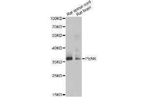 Western blot analysis of extracts of various cell lines, using PENK antibody. (Enkephalin 抗体)