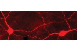 Immunostaining of light-stimulated rabbit retina showing labeling of TH when phosphorylated at Ser40. (Tyrosine Hydroxylase 抗体  (pSer40))