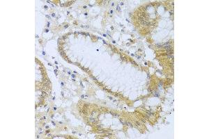 Immunohistochemistry of paraffin-embedded human stomach using ACP1 antibody at dilution of 1:100 (x40 lens). (ACP1 抗体)