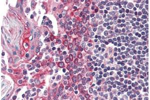 Human Tonsil (formalin-fixed, paraffin-embedded) stained with CSNK1E antibody ABIN337139 at 5 ug/ml followed by biotinylated anti-goat IgG secondary antibody ABIN481715, alkaline phosphatase-streptavidin and chromogen. (CK1 epsilon 抗体  (AA 403-416))