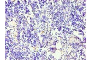 Immunohistochemistry of paraffin-embedded human thymus tissue using ABIN7158650 at dilution of 1:100 (CD58 抗体  (AA 40-220))