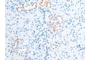 ABIN6267250 at 1/100 staining rat kidney tissue sections by IHC-P.