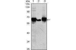 Western blot analysis using ALPP mouse mAb against HepG2 (1), A431 (2) and MCF-7 (3) cell lysate. (PLAP 抗体)