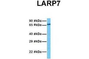 Host:  Rabbit  Target Name:  L Sample Tissue:  Human Hela  Antibody Dilution:  1. (LARP7 抗体  (C-Term))