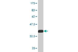 Western Blot detection against Immunogen (36. (MPP1 抗体  (AA 1-98))