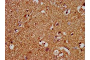 IHC image of ABIN7160821 diluted at 1:400 and staining in paraffin-embedded human brain tissue performed on a Leica BondTM system. (NLRP1 抗体  (AA 589-655))
