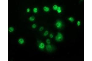 Anti-TP53 mouse monoclonal antibody (ABIN2454501) immunofluorescent staining of COS7 cells transiently transfected by pCMV6-ENTRY TP53 (RC200003). (p53 抗体)