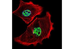 Fluorescent confocal image of SK-BR-3 cell stained with USF1 Antibody (Center) (ABIN655030 and ABIN2844661). (USF1 抗体  (AA 174-201))