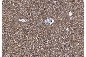 IHC analysis of MTTP using anti-MTTP antibody (ABIN7601145). (MTTP 抗体  (AA 29-702))