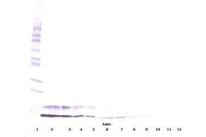 Image no. 1 for anti-Insulin-Like Growth Factor 1 (IGF1) antibody (ABIN464965) (IGF1 抗体)