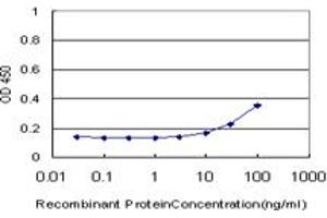 Detection limit for recombinant GST tagged GTF3A is approximately 10ng/ml as a capture antibody. (GTF3A 抗体  (AA 185-274))