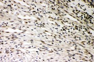 IHC analysis of SMURF1 using anti-SMURF1 antibody (ABIN3044547).