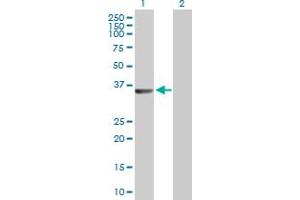 Western Blot analysis of RLBP1 expression in transfected 293T cell line by RLBP1 MaxPab polyclonal antibody. (RLBP1 抗体  (AA 1-317))