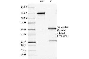 SDS-PAGE (SDS) image for anti-CD68 Molecule (CD68) antibody (ABIN6941239)
