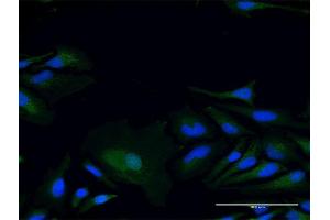 Immunofluorescence of purified MaxPab antibody to LY96 on HeLa cell.