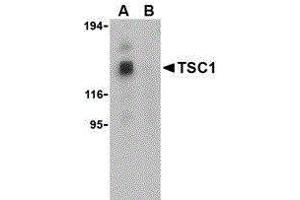 Western Blotting (WB) image for anti-Tuberous Sclerosis 1 (TSC1) (Center) antibody (ABIN2476985) (TSC1 抗体  (Center))