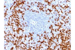 Formalin-fixed, paraffin-embedded human spleen stained with MMP9 Rabbit Recombinant Monoclonal Antibody (MMP9/2025R).