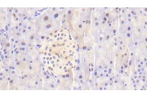 Immunohistochemistry (IHC) image for anti-Nucleoporin 88kDa (NUP88) (AA 57-296) antibody (ABIN7441823)