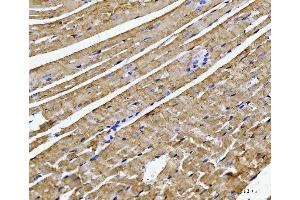 IHC analysis of ATP5F1B using anti-ATP5F1B antibody (ABIN7599866). (Atp5f1b (AA 123-529) 抗体)