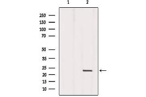 Western blot analysis of extracts from Mouse liver, using Dermatopontin Antibody. (Dermatopontin 抗体  (Internal Region))