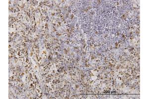 Immunostaining (ISt) image for anti-CD177 Molecule (CD177) (AA 21-120) antibody (ABIN566092)