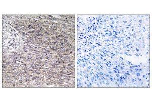 Immunohistochemistry (IHC) image for anti-Chondroitin Polymerizing Factor (CHPF) (C-Term) antibody (ABIN1851108) (CHPF 抗体  (C-Term))