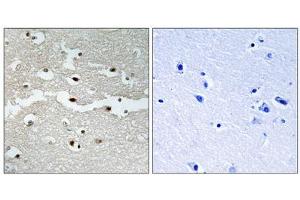 Immunohistochemistry analysis of paraffin-embedded human brain tissue, using BRCA2 antibody.