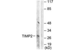 Western blot analysis of extracts from A549 cells, using TIMP2 Antibody. (TIMP2 抗体  (AA 21-70))